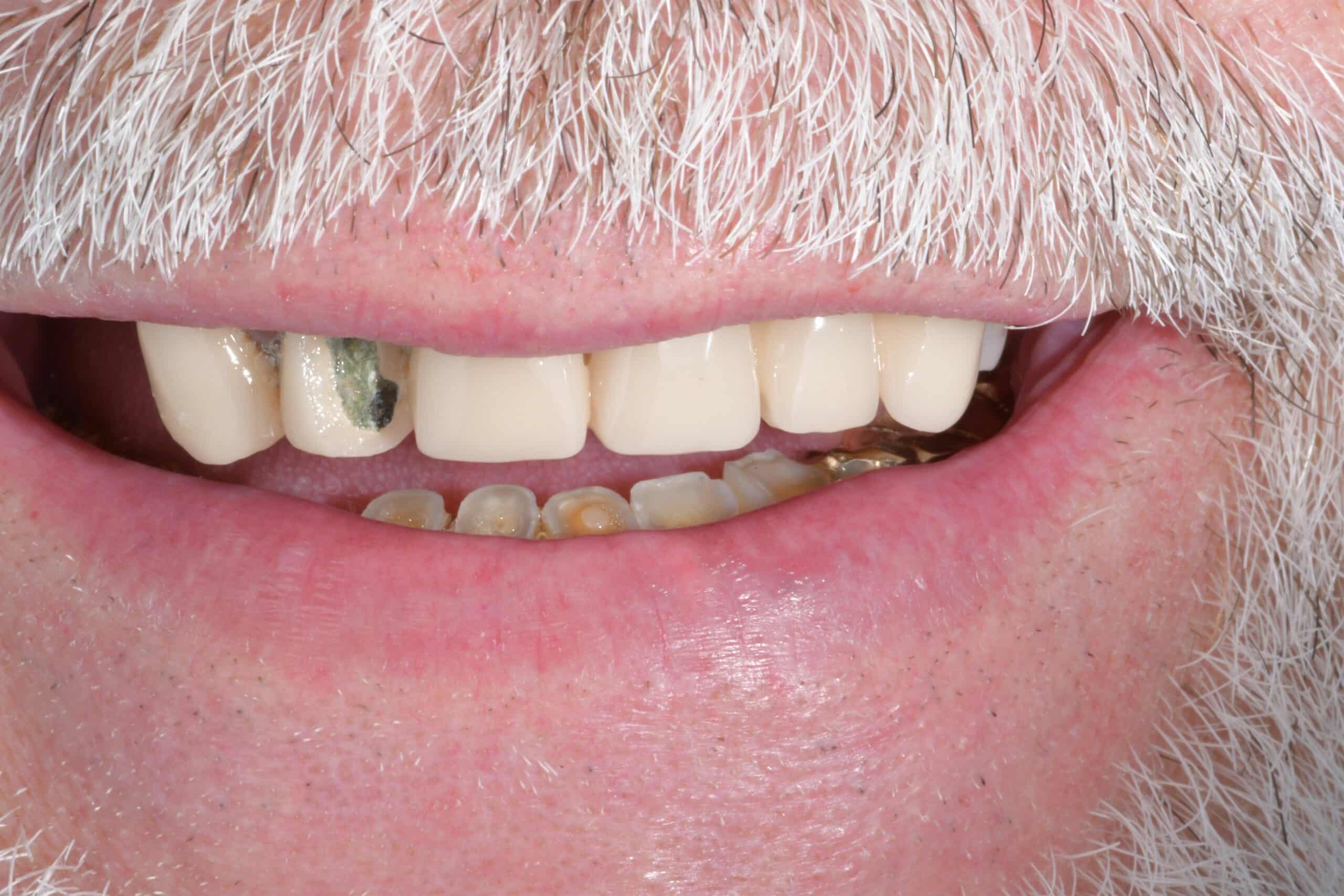 DSC_0138 Mass Image Compressor Compressed this image. https://sourceforge.net/projects/icompress/ with Quality:80