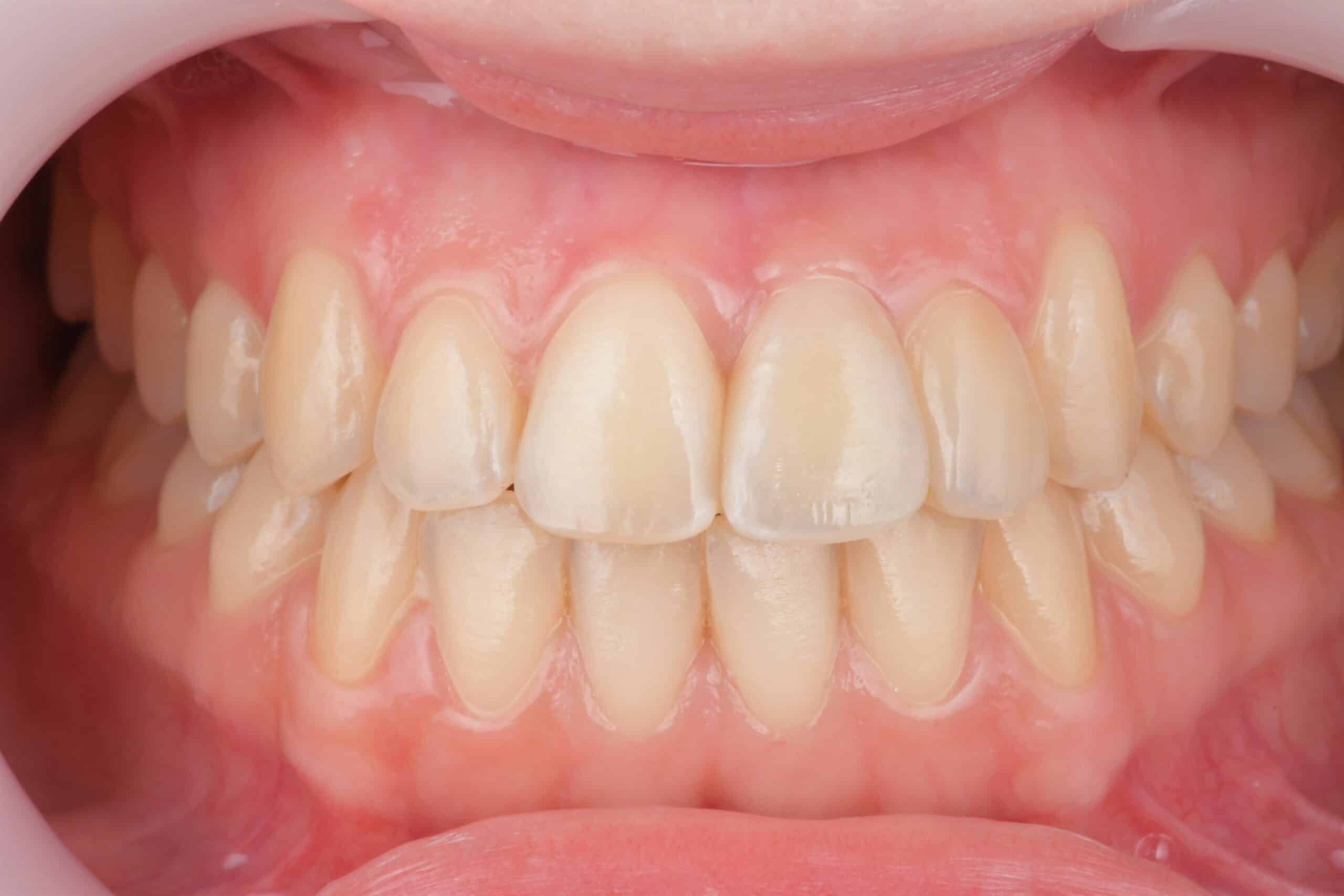 Mass Image Compressor Compressed this image. https://sourceforge.net/projects/icompress/ with Quality:80