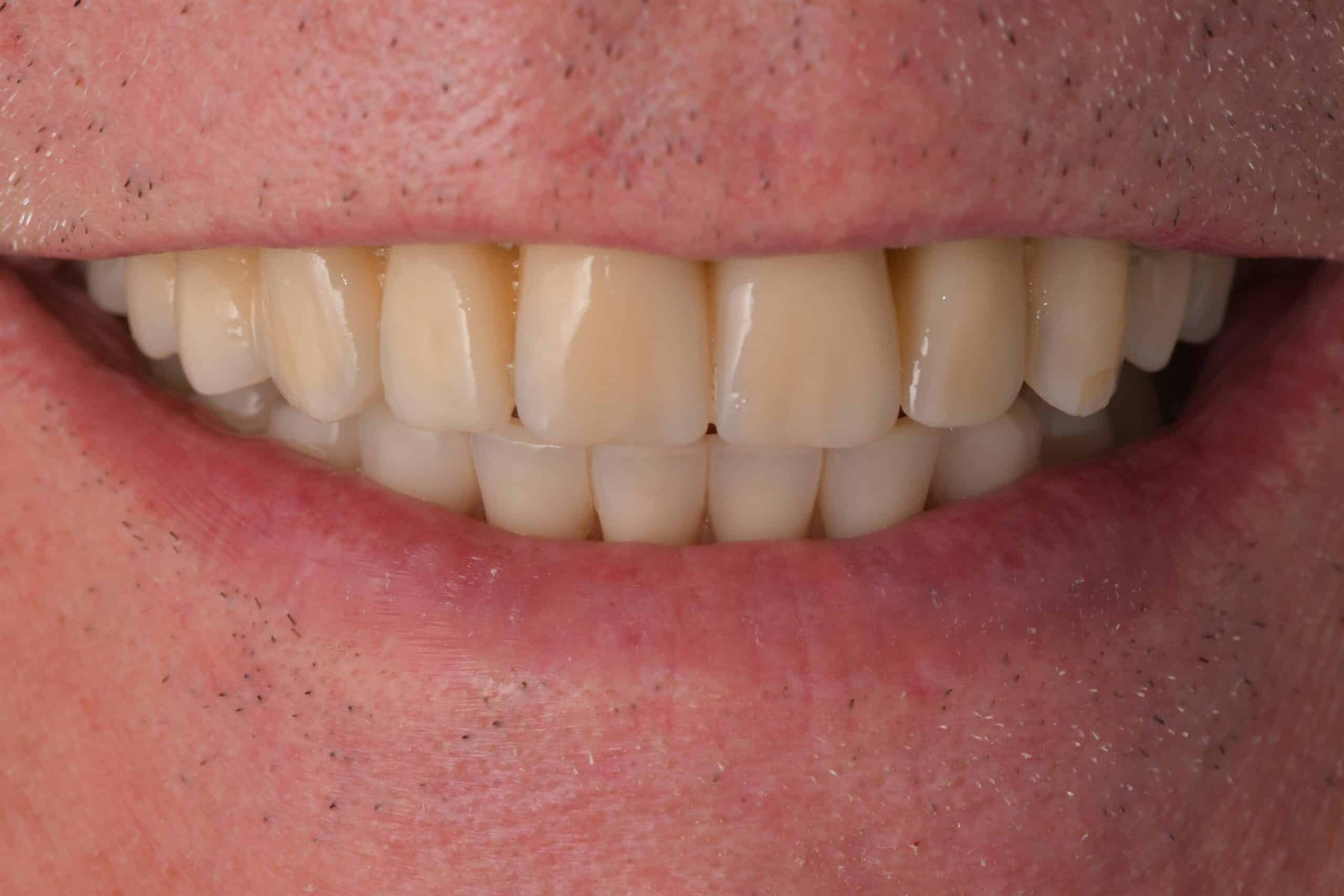 Mass Image Compressor Compressed this image. https://sourceforge.net/projects/icompress/ with Quality:80